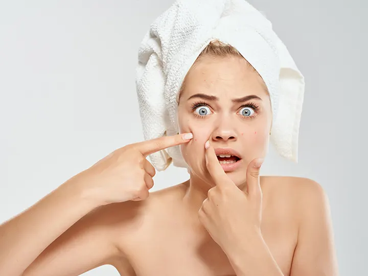 What Happens if You Pop Your Pimples?