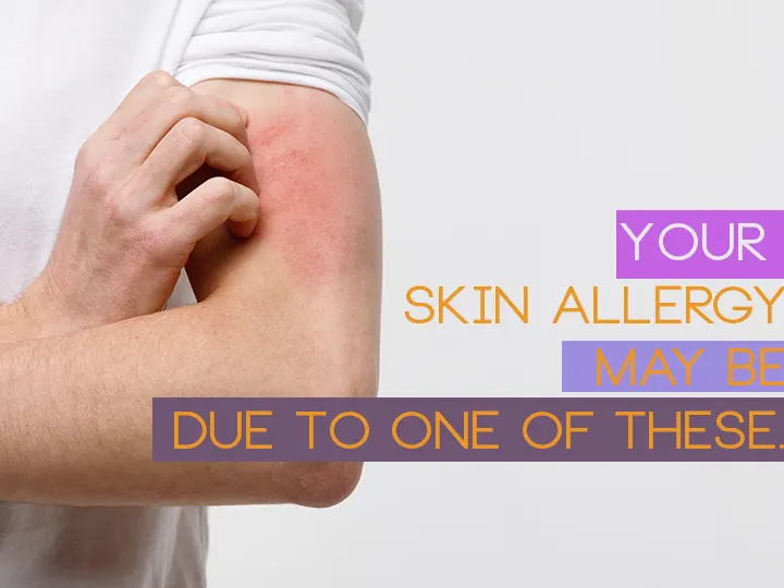 Your Skin Allergy May Be Due to One of These